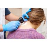 5 leziuni comune ale pielii - cum le identifici și ce semnificație au