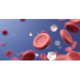 Ce &icirc;nseamnă glicemie 128? Valoare normală sau semn de diabet?