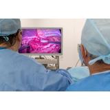 Beneficiile chirurgiei toracice minim invazive: cum &icirc;mbunătățește tehnologia video-asistată rezultatele