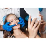 Beneficiile fațetelor dentare: Cum pot acestea să &icirc;ți &icirc;mbunătățească z&acirc;mbetul și &icirc;ncrederea &icirc;n sine?