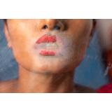 Buze mai pline și mai definite: Ce trebuie să știi despre injectarea cu acid hialuronic