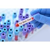 Ce este hemoleucograma completă și c&acirc;nd se recomandă?