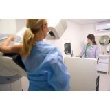 Tipuri de mamografie și diferențele dintre ele