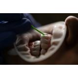 Top 3 avantaje ale fațetelor dentare 