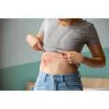 Zona Zoster: prin ce simptome se manifestă și cum se poate trata