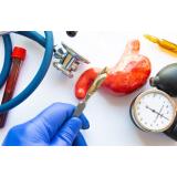 Bariatria: Despre operatie si beneficii