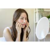 Cum să &icirc;ngrijești corect tenul cuperozic: 5 recomandări utile