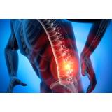 Cum tratăm eficient afecțiunile din zona lombară ?