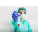 OMS: 5.322 de cazuri de variola maimuței &icirc;nregistrate &icirc;n lume