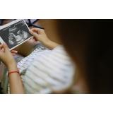 Mai multe ONG-uri cer Guvernului să deconteze avortul la cerere prin CNAS