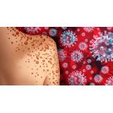 Rom&acirc;nia &icirc;nregistrează &icirc;ncă un caz de variola maimuței. Bilanțul total al infectărilor