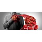 Simptome că un cheag blochează circulația s&acirc;ngelui &icirc;n diverse părți ale corpului