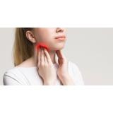 10 semne ca ai probleme cu tiroida - simptome și manifestări care duc la crize de glanda tiroida