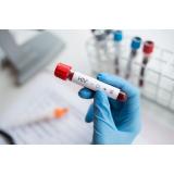 Testare gratuită pentru HIV și hepatita C. Unde te poți testa