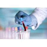 Top 7 analize de s&acirc;nge pentru sănătatea ta 