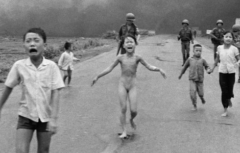 Ranile celebrei "Napalm Girl", vindecate