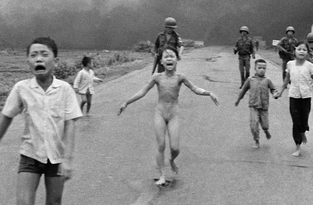 Ranile celebrei "Napalm Girl", vindecate cu ajutorul unui tratament revolutionar cu laser, in Miami