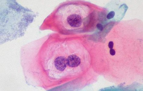 Cancerul provocat de sexul oral, subiect de documentar