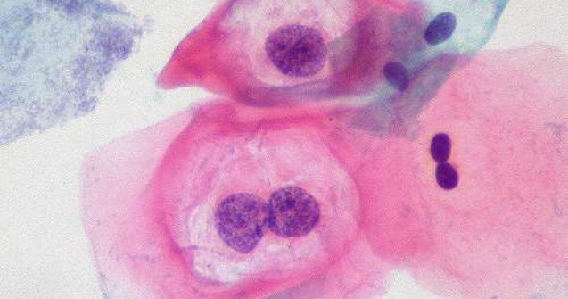 Cancerul provocat de sexul oral, subiect de documentar