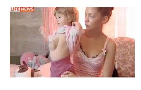  Video  O rusoaica s-a nascut cu inima in afara corpului