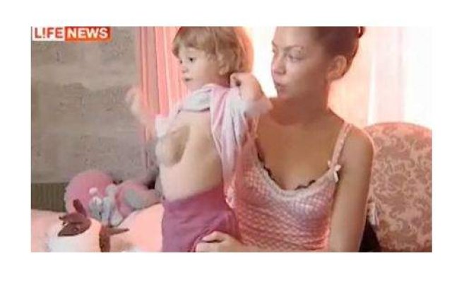 [VIDEO] O rusoaica s-a nascut cu inima in afara corpului