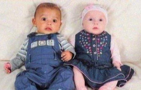  Video  O britanica a nascut gemeni de culori diferite