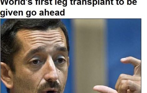 Un chirurg spaniol va efectua primul transplant simultan de picioare