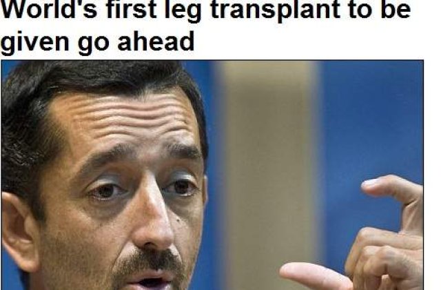 Un chirurg spaniol va efectua primul transplant simultan de picioare