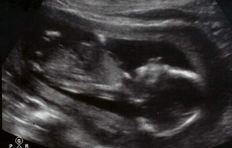 O familie de americani liciteaza viata fiului lor pe internet