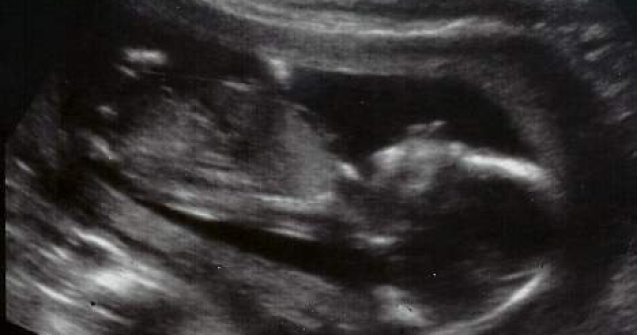 O familie de americani liciteaza viata fiului lor pe internet