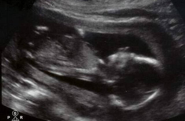 O familie de americani liciteaza viata fiului lor pe internet