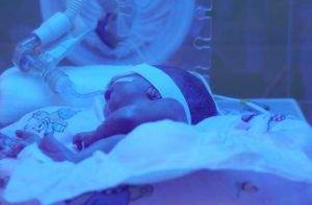 [VIDEO] Gemeni nascuti prematur, declarati avort