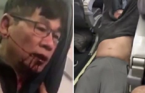 Pasagerul scos cu forta dintr-un avion United Airlines a dat in judecata compania aeriana