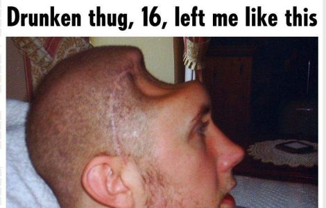 A ramas fara o bucata de cap