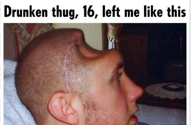 A ramas fara o bucata de cap