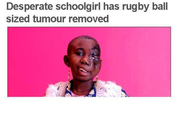 [FOTO] Tumoare cat mingea de rugby, operata cu succes