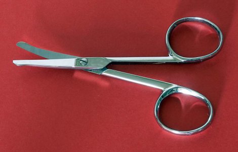 A ramas cu doua foarfece in abdomen, in urma unei operatii