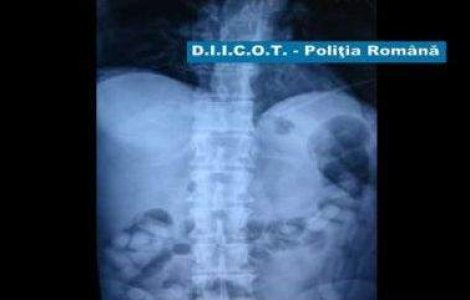 A ingerat un kilogram de cocaina