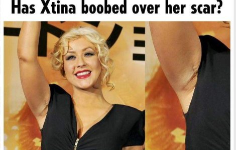  Foto  Operatiile la sani i-au lasat urme vizibile Christinei Aguilera