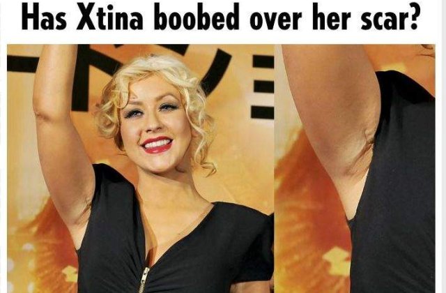 [FOTO] Operatiile la sani i-au lasat urme vizibile Christinei Aguilera