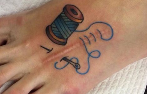  Top  15 tatuaje care transforma cicatricile in adevarate opere de arta