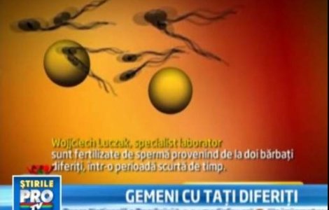  Video  Doi gemeni din Polonia au aceeasi mama, dar tati diferiti