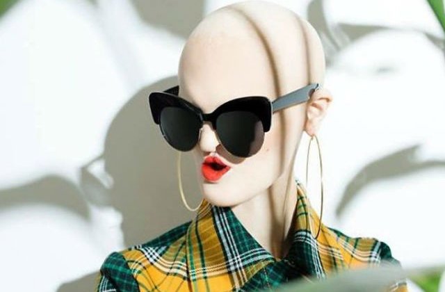 [FOTO] Sufera de o boala genetica rara, dar asta nu a impiedicat-o sa devina model