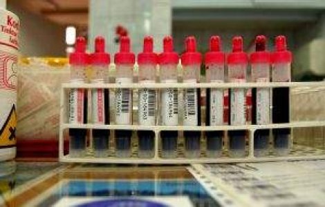 Un nou test pentru detectarea timpurie a celulelor canceroase, in curand pe piata