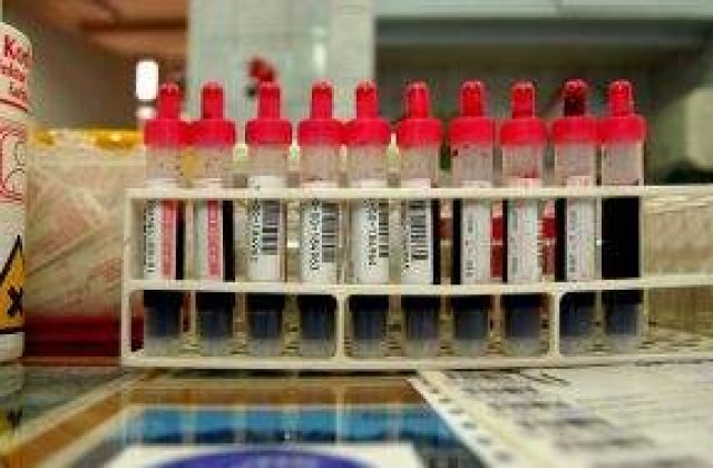Un nou test pentru detectarea timpurie a celulelor canceroase, in curand pe piata