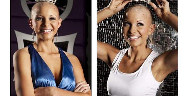  Video  O tanara cheala ar putea fi Miss America