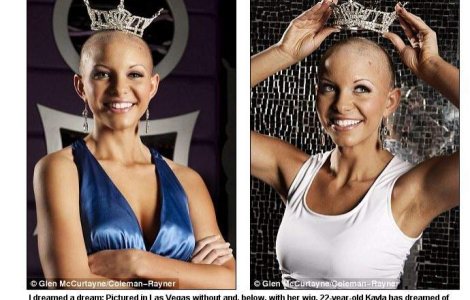  Video  O tanara cheala ar putea fi Miss America