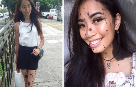 I-au spus ca e un monstru. Acum, participa la auditiile Miss Universe