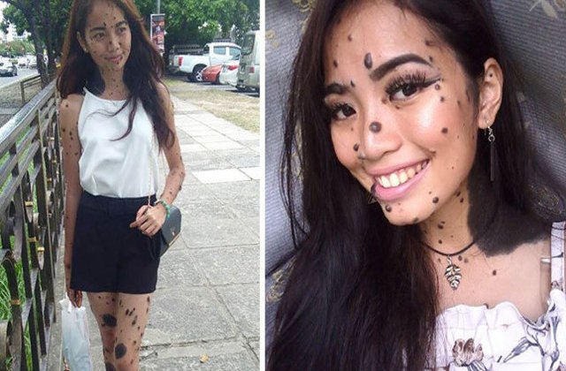 [FOTO] I s-a spus ca este un monstru. Acum, tanara se prezinta la auditiile pentru Miss Universe