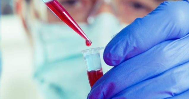 Brazilia a inceput sa vanda teste HIV in farmacii